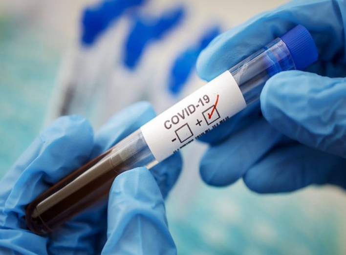 У Сумах за тиждень на коронавірус захворіло 39 мешканців: 1 летальний випадок фото