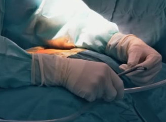 Хірургія з роботом: у Medical Plaza розповіли, коли Da Vinci дає перевагу перед руками хірурга