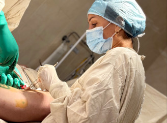 Що таке варикоз – розмова з сумською судинною хірургинею