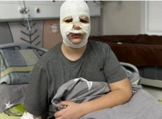 У Львові трьох дітей госпіталізували після спроби зробити вибухівку за інструкцією з TikTok