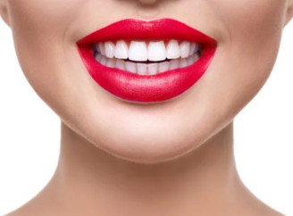 Вініри: естетичне відновлення посмішки та сучасні методи встановлення