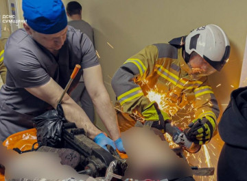У Сумах рятувальники визволяли ноги чоловіка з фрези культиватора прямо в лікарні