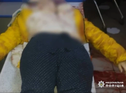 Ворожі війська атакували Середина-Буду: загинули двоє дорослих та дитина фото