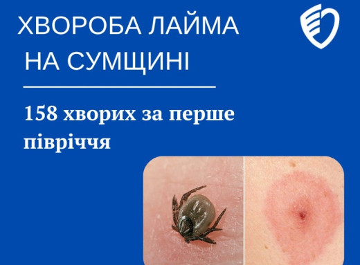 Зростання випадків кліщового бореліозу на Сумщині: 158 хворих за пів року фото Зростання випадків кліщового бореліозу на Сумщині: 158 хворих за пів року фото