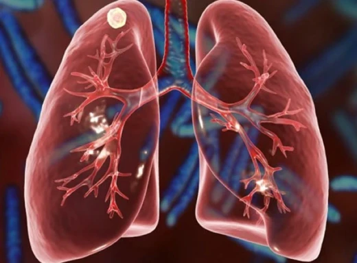 На Сумщині зростає кількість хворих на туберкульоз фото