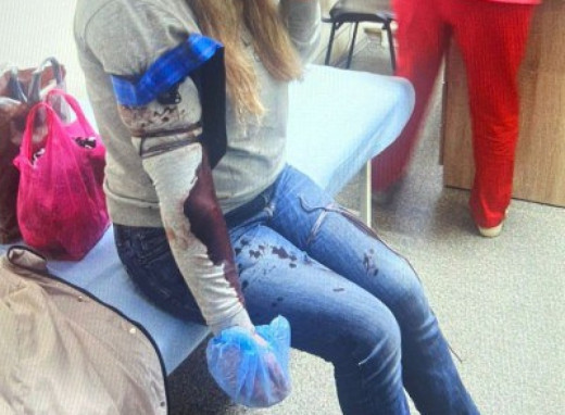 У Шостці двоє людей отримали поранення під час роботи ППО фото