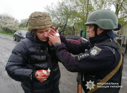 На Дніпропетровщині чоловік кинув гранату в поліцейських: п’ятеро поранених фото