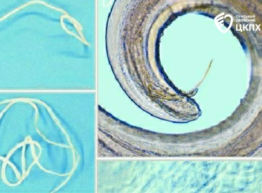 У Сумах виявили рідкісне паразитарне захворювання – дирофіляріоз фото