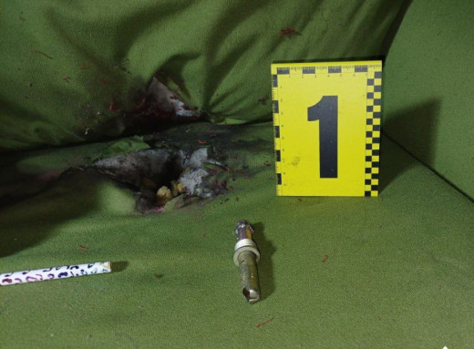 У Сумах через вибух запалу від гранати постраждала дитина: ДБР почало розслідування фото