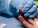 Сумщина лідирує в Україні із захворюваності на вірусні гепатити